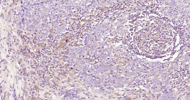 ROCK1 Antibody in Immunohistochemistry (Paraffin) (IHC (P))