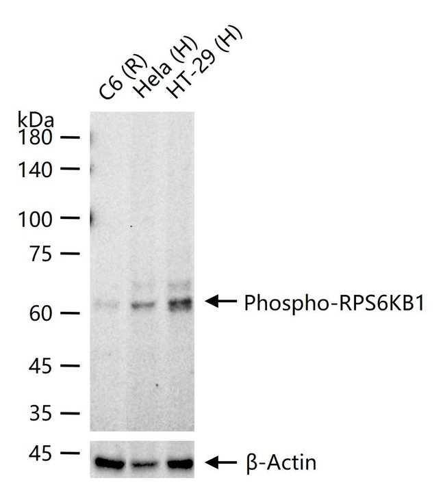 Phospho-p70 S6 Kinase (Thr421, Ser424) Antibody in Western Blot (WB)