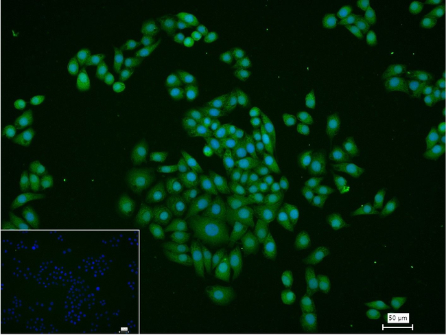 RPS6KB2 Antibody in Immunocytochemistry (ICC/IF)