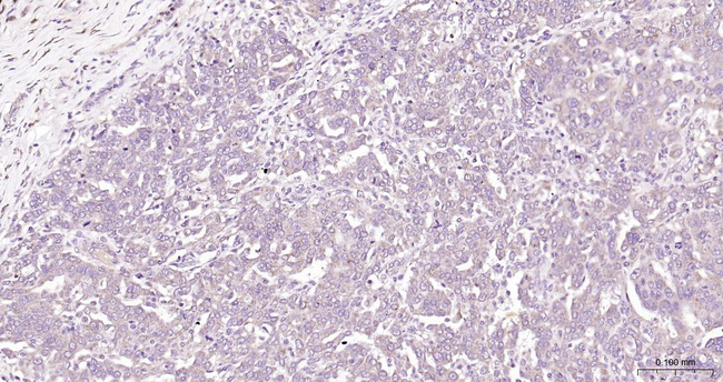 EDG3 Antibody in Immunohistochemistry (Paraffin) (IHC (P))
