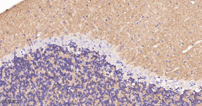 SNAP25 Antibody in Immunohistochemistry (Paraffin) (IHC (P))