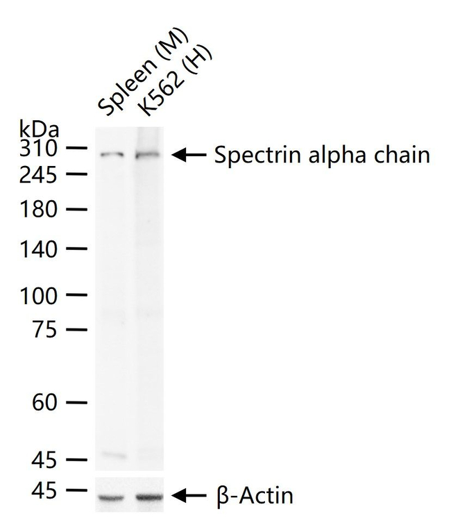 Spectrin alpha-1 Antibody in Western Blot (WB)