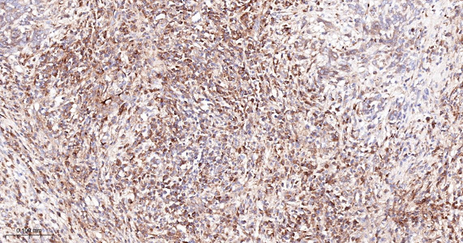 TIMP1 Antibody in Immunohistochemistry (Paraffin) (IHC (P))