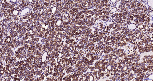 Thyroid Peroxidase Antibody in Immunohistochemistry (Paraffin) (IHC (P))