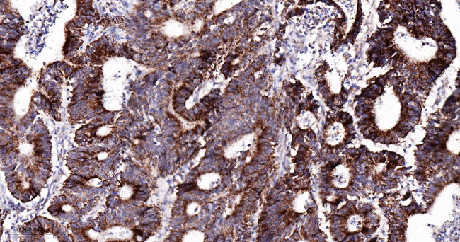 TRAP1 Antibody in Immunohistochemistry (Paraffin) (IHC (P))