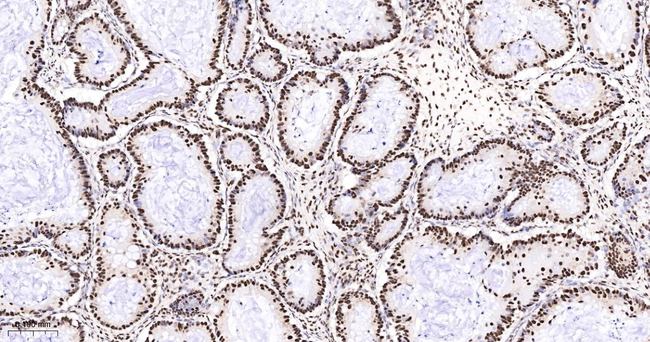 TRIM28 Antibody in Immunohistochemistry (Paraffin) (IHC (P))