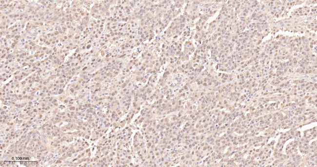 UBE1 Antibody in Immunohistochemistry (Paraffin) (IHC (P))