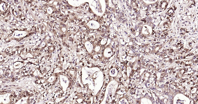 Ub-K48 Antibody in Immunohistochemistry (Paraffin) (IHC (P))