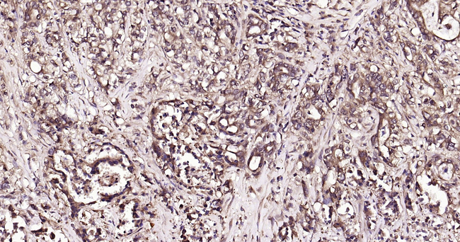 Ub-K63 Antibody in Immunohistochemistry (Paraffin) (IHC (P))