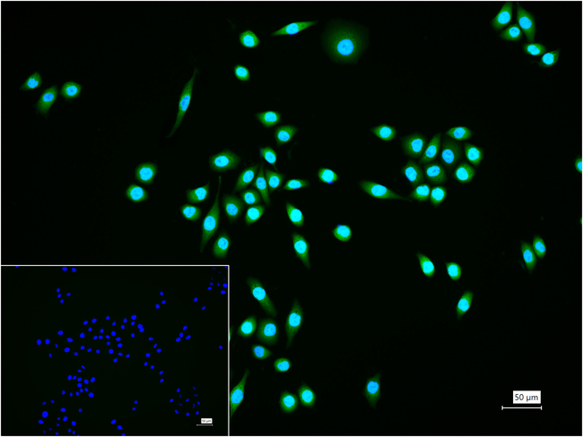 Ubiquitin (linkage specific K27) Antibody in Immunocytochemistry (ICC/IF)