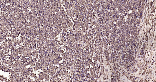 Ubiquitin Antibody in Immunohistochemistry (Paraffin) (IHC (P))