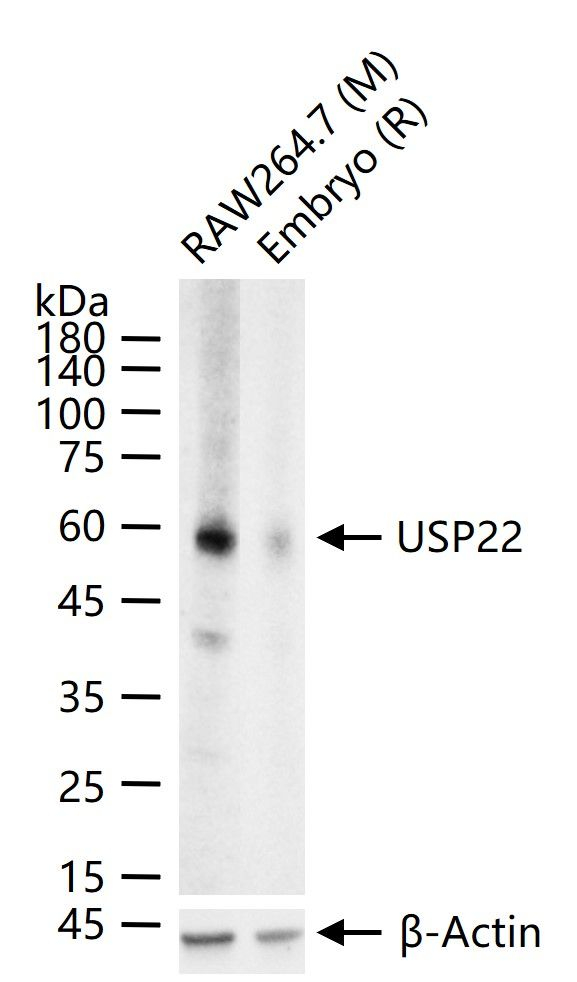 USP22 Antibody in Western Blot (WB)