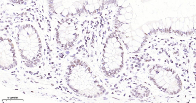 USP28 Antibody in Immunohistochemistry (Paraffin) (IHC (P))