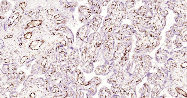 VEGF Antibody in Immunohistochemistry (Paraffin) (IHC (P))