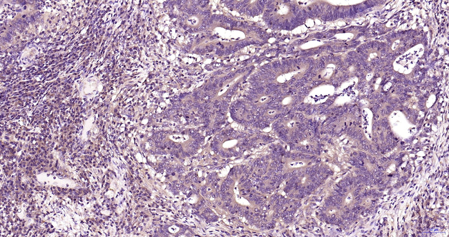 MEK2 Antibody in Immunohistochemistry (Paraffin) (IHC (P))