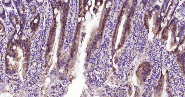 E-cadherin Antibody in Immunohistochemistry (Paraffin) (IHC (P))