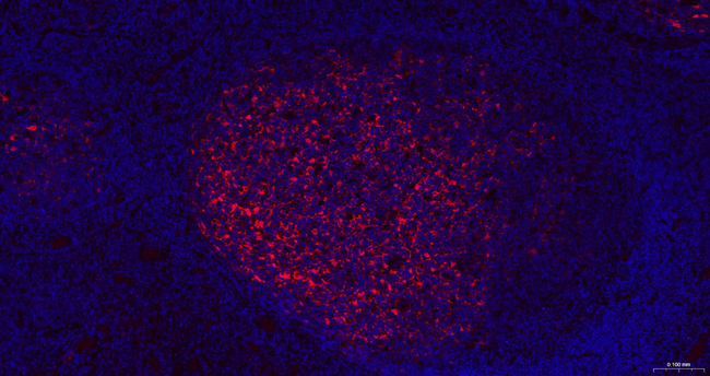 S100A1 Antibody in Immunohistochemistry (Paraffin) (IHC (P))