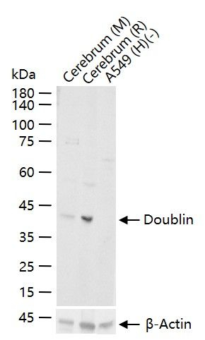 Doublecortin Antibody in Western Blot (WB)