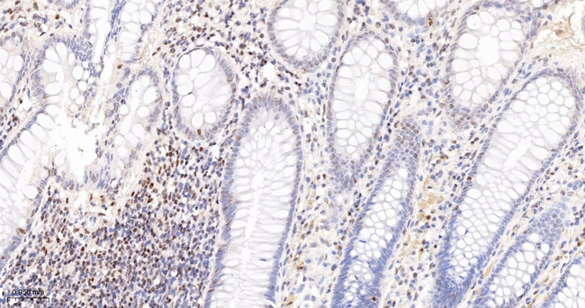 ATM Antibody in Immunohistochemistry (Paraffin) (IHC (P))