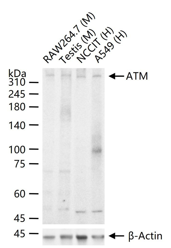 ATM Antibody in Western Blot (WB)