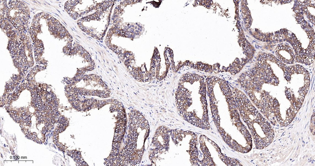 BAD Antibody in Immunohistochemistry (Paraffin) (IHC (P))