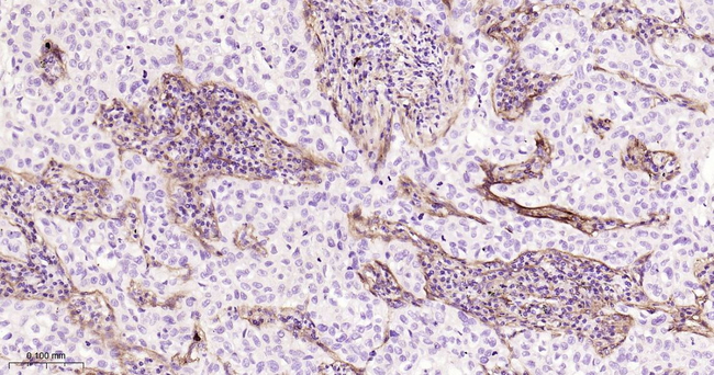FAP Antibody in Immunohistochemistry (Paraffin) (IHC (P))