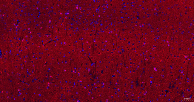 Phospho-Tau (Ser404) Antibody in Immunohistochemistry (Paraffin) (IHC (P))