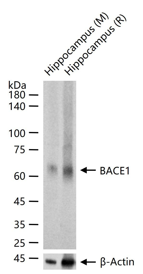 BACE1 Antibody in Western Blot (WB)