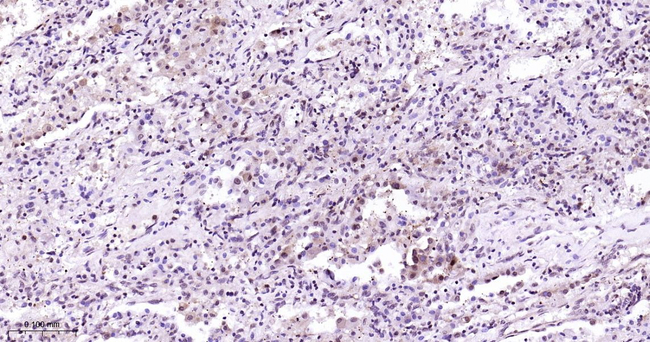 p38 MAPK Antibody in Immunohistochemistry (Paraffin) (IHC (P))