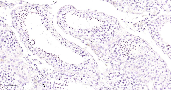 MBD1 Antibody in Immunohistochemistry (Paraffin) (IHC (P))
