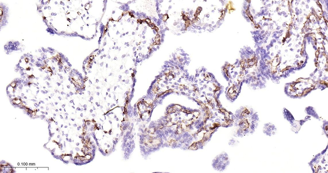 VEGF Receptor 2 Antibody in Immunohistochemistry (Paraffin) (IHC (P))