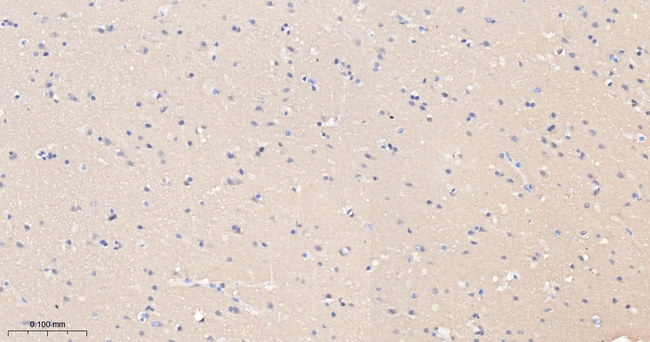 GOT1 Antibody in Immunohistochemistry (Paraffin) (IHC (P))