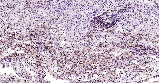 Phospho-mTOR (Ser2481) Antibody in Immunohistochemistry (Paraffin) (IHC (P))