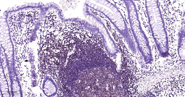 STAT5 alpha/beta Antibody in Immunohistochemistry (Paraffin) (IHC (P))