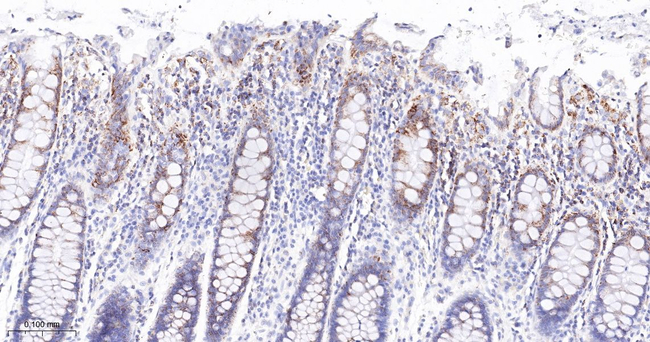 Phospho-PDHA1 (Ser293) Antibody in Immunohistochemistry (Paraffin) (IHC (P))