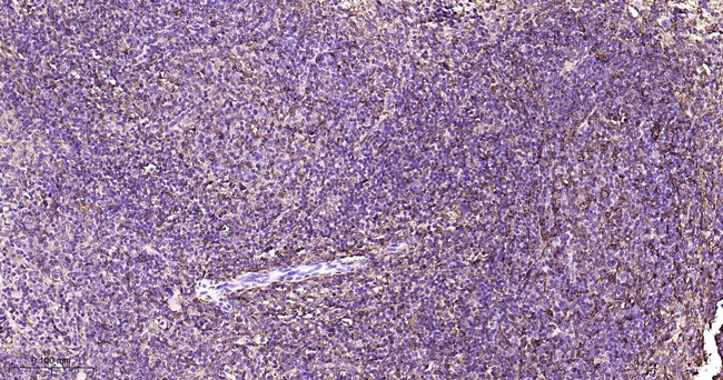 Ferritin Antibody in Immunohistochemistry (Paraffin) (IHC (P))