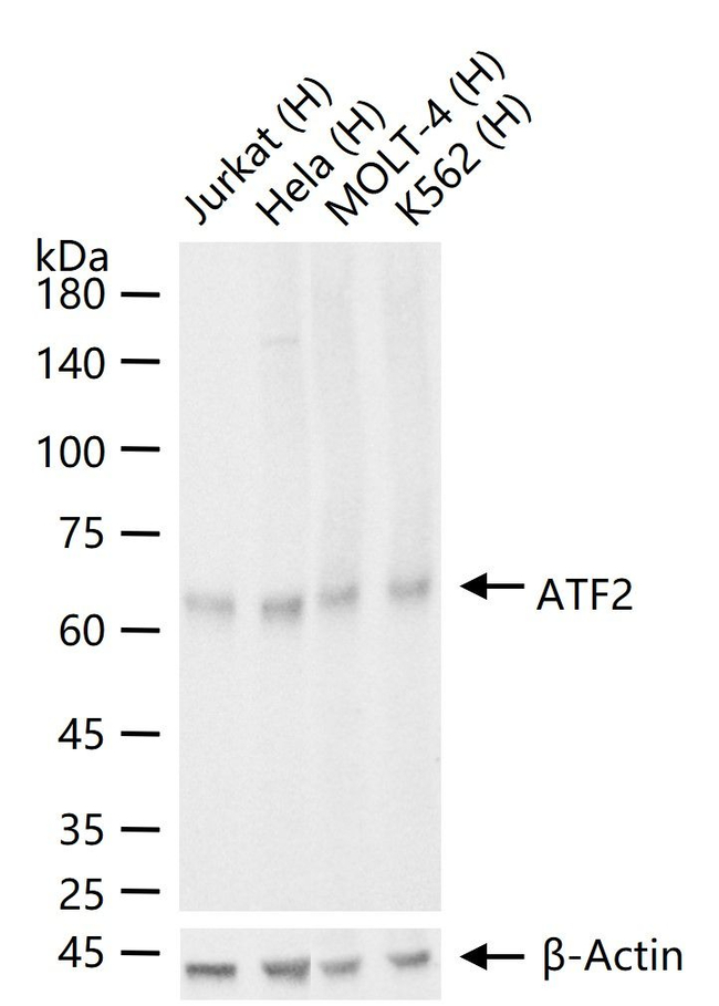 ATF2 Antibody in Western Blot (WB)