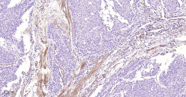 MMP1 Antibody in Immunohistochemistry (Paraffin) (IHC (P))