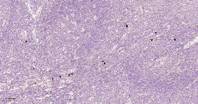 Human IgG4 Antibody in Immunohistochemistry (Paraffin) (IHC (P))