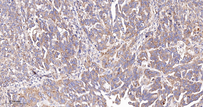 FAK Antibody in Immunohistochemistry (Paraffin) (IHC (P))