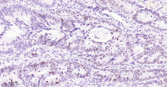 Rb Antibody in Immunohistochemistry (Paraffin) (IHC (P))