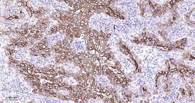 Cytokeratin 6 Antibody in Immunohistochemistry (Paraffin) (IHC (P))