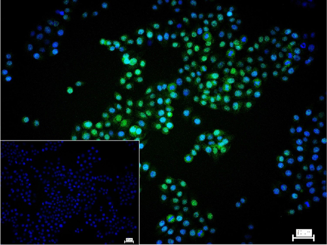 CDK4 Antibody in Immunocytochemistry (ICC/IF)