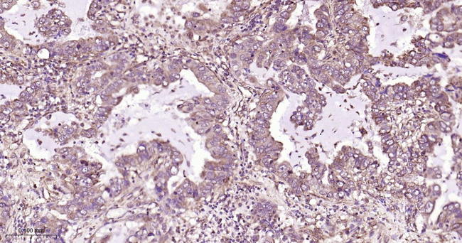 Phospho-mTOR (Ser2448) Antibody in Immunohistochemistry (Paraffin) (IHC (P))