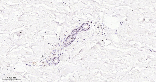 MiTF Antibody in Immunohistochemistry (Paraffin) (IHC (P))
