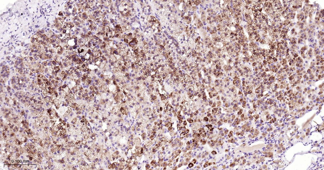 STAR Antibody in Immunohistochemistry (Paraffin) (IHC (P))
