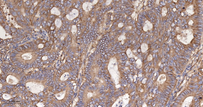 IFITM3 Antibody in Immunohistochemistry (Paraffin) (IHC (P))