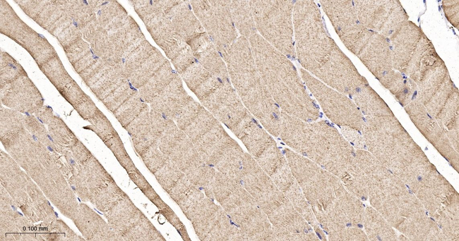 PFKM Antibody in Immunohistochemistry (Paraffin) (IHC (P))