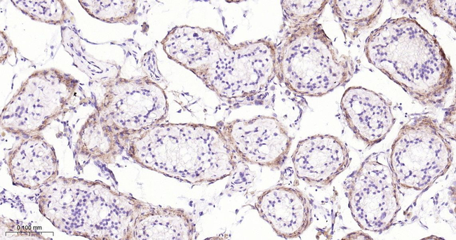 Versican Antibody in Immunohistochemistry (Paraffin) (IHC (P))