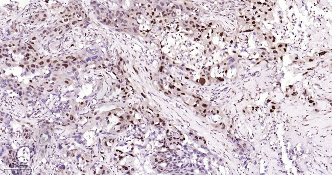 Phospho-p38 MAPK (Thr180) Antibody in Immunohistochemistry (Paraffin) (IHC (P))
